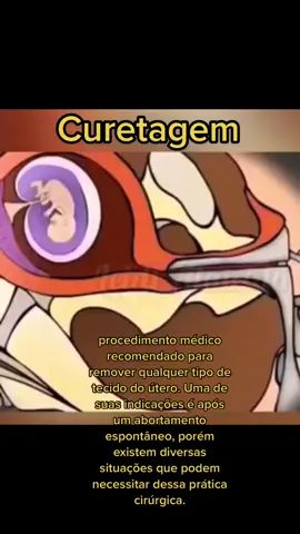 #procedimentomedico #curetagem #obstetricia #abortoespontaneo💔 #mae #bemestar #fy #fyp #foryou 