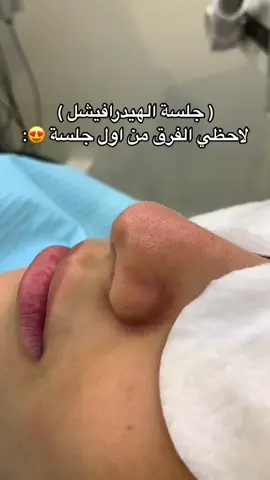 جلسة تنظيف بشرة (هيدرافيشل) #الشعب_الصيني_ماله_حل😂😂 #explore #fyp 