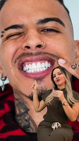 ¿Te gusta el resultado? @Artistas de Sonrisas ✨  #rauwalejandro #reggaeton #artistas #veneers #ceramicveneers  
