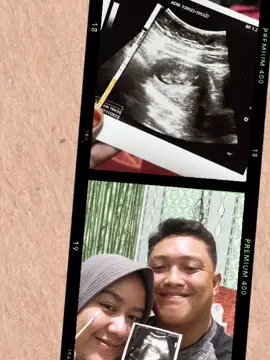 Masya Allah tabarakallah . kado terindah diusia 27 tahun . sehat-sehat untuk kita ya nak . semoga kita slalu dalam lindungan Allah .   Amin 🤗