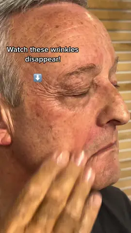 Dramatic results in 3 minutes!?! 😱 #AntiAging #AgelessBeauty #YouthfulSkin #AntiAgingSkincare 