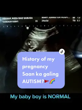 Sharing with you my history of pregnancy. Bakit kaya my autism baby ko? Saan ka nang galing autism? #autismawareness #autism  #autismmom #historyofmypregnancy #covid19patient #covid19baby #normalparentsautism #autismbaby #fyp #fypage #foryoupage #2020pregnancy  #autismbaby