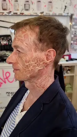 real or fake ? scarification burn fx makeup application #makeup #fx #fxmakeup #specialeffects #makeover #writer #burn 