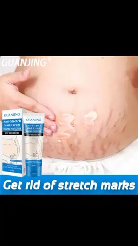 【buy 2 take 1】stretch mark cream Specially developed for pregnant women 80ml  Visit my tiktok shop for more items ! ! ! #stretchmarkremoval #strechmarkcream #tiktokaffiliate 