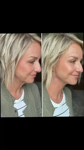 Secret Lift Pro Neck amd Jaw Bands! Perfect for my 40+ loose skin 😜😜 #looseneckskin #necklift #instantnecklift #jowlsfordays #justforfun #secretliftpro #facetape #necktape 