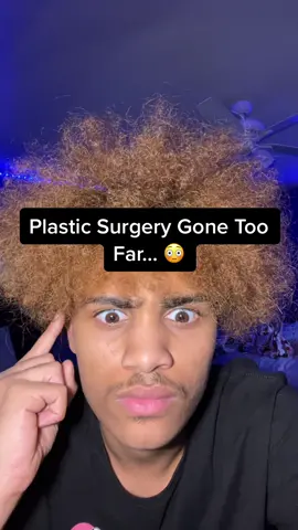 Plastic Surgery Gone Too Far… 😳 #fyp #xyzbca #viral #fypシ #foryoupage 
