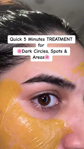 Quick Fix For Dark Circles, Spots & Patches🌼 #foryoupage #foryou #trending #skin #skincare #clearskin #acne #acneskin #asiangirl #desi 