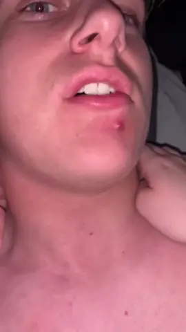 Wow high volocity #fyp #satisfying #pop ##pimple