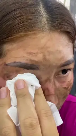 #fyp #trending #viral #skincare 