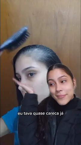 #maternidade #amamentação #cabelo #quedadecabelo 