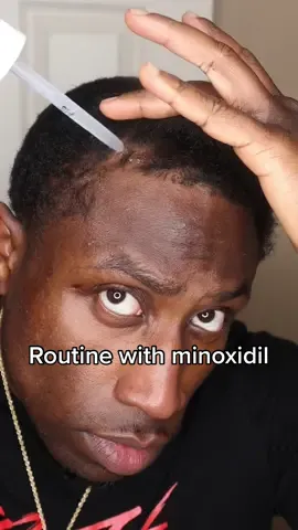 How I include minoxidil in my hair routine.⁣ 1️⃣. Apply minoxidil to thin spots. ⁣ 2️⃣. let it dry. ⁣ 3️⃣. Apply “360 Silk Moisturizer” and brush few minutes.⁣ 4️⃣. Apply “360 Silk Potion” and have a brush session. ⁣ 5️⃣. Apply Durag. ⁣ ⁣ All of my premium hair products are available at: www.360silk.store Or 𝐜𝐥𝐢𝐜𝐤 𝐭𝐡𝐞 𝐥𝐢𝐧𝐤 𝐢𝐧 𝐦𝐲 𝐛𝐢𝐨⁣⁣⁣⁣⁣⁣⁣⁣⁣⁣⁣⁣⁣⁣⁣⁣⁣⁣⁣⁣⁣⁣⁣⁣⁣⁣⁣⁣⁣⁣⁣⁣⁣⁣⁣⁣⁣⁣⁣⁣⁣⁣⁣⁣⁣⁣⁣⁣⁣⁣⁣⁣⁣⁣⁣⁣⁣⁣⁣⁣⁣⁣⁣⁣⁣⁣⁣⁣⁣⁣⁣⁣⁣⁣⁣⁣⁣⁣⁣⁣⁣⁣⁣⁣⁣⁣⁣⁣⁣⁣⁣⁣⁣⁣⁣⁣⁣⁣⁣⁣⁣⁣⁣⁣⁣⁣⁣⁣⁣⁣⁣⁣⁣⁣⁣⁣⁣⁣⁣⁣⁣⁣⁣⁣⁣⁣⁣⁣⁣⁣⁣⁣⁣⁣⁣⁣⁣⁣⁣⁣⁣⁣⁣⁣⁣⁣⁣⁣⁣⁣⁣⁣⁣ #5StarProduct 🌟🌟🌟🌟🌟⁣⁣⁣⁣⁣⁣⁣⁣⁣⁣⁣⁣⁣⁣⁣⁣⁣⁣⁣⁣⁣⁣⁣⁣⁣⁣⁣⁣⁣⁣⁣⁣⁣⁣⁣⁣⁣⁣⁣⁣⁣⁣⁣⁣⁣⁣⁣⁣⁣⁣⁣⁣⁣⁣⁣⁣⁣⁣⁣⁣⁣⁣⁣⁣⁣⁣⁣⁣⁣⁣⁣⁣⁣⁣⁣⁣⁣⁣⁣⁣ 𝐃𝐢𝐬𝐜𝐨𝐮𝐧𝐭 𝐂𝐨𝐝𝐞: “Silkteam” 𝐟𝐨𝐫 𝟏𝟎% 𝐨𝐟𝐟✅⁣⁣⁣⁣⁣⁣⁣⁣⁣⁣⁣⁣⁣⁣⁣⁣⁣⁣⁣⁣⁣⁣⁣⁣⁣⁣⁣⁣⁣⁣⁣⁣⁣⁣⁣⁣⁣⁣⁣⁣⁣⁣⁣⁣⁣⁣⁣⁣⁣⁣⁣⁣⁣⁣⁣⁣⁣⁣⁣⁣⁣⁣⁣⁣⁣⁣⁣⁣⁣⁣⁣⁣ ______________________________________⁣⁣⁣⁣⁣⁣⁣⁣⁣⁣⁣⁣⁣⁣⁣⁣⁣⁣⁣⁣⁣⁣⁣⁣⁣⁣⁣⁣⁣⁣⁣⁣⁣⁣⁣⁣⁣⁣⁣⁣⁣⁣⁣⁣⁣⁣⁣⁣⁣⁣⁣⁣⁣⁣⁣⁣⁣⁣⁣⁣⁣⁣⁣⁣⁣⁣⁣⁣⁣⁣⁣⁣⁣⁣⁣⁣⁣⁣⁣⁣⁣⁣⁣⁣⁣⁣⁣⁣⁣⁣⁣⁣⁣⁣⁣⁣⁣⁣⁣⁣⁣⁣⁣⁣⁣⁣⁣⁣⁣⁣⁣⁣⁣⁣⁣⁣⁣⁣⁣⁣⁣⁣⁣⁣⁣⁣⁣⁣⁣⁣⁣⁣⁣⁣⁣⁣⁣⁣⁣⁣⁣⁣⁣⁣⁣⁣⁣⁣⁣⁣⁣⁣⁣⁣⁣⁣⁣⁣⁣⁣⁣⁣⁣⁣⁣⁣⁣⁣⁣⁣⁣⁣⁣⁣⁣⁣⁣⁣⁣⁣⁣⁣⁣⁣⁣⁣⁣⁣⁣⁣⁣⁣⁣⁣⁣ -Worldwide Shipping🌏⁣⁣⁣⁣⁣⁣⁣⁣⁣⁣⁣⁣⁣⁣⁣⁣⁣⁣⁣⁣⁣⁣⁣⁣⁣⁣⁣⁣⁣⁣⁣⁣⁣⁣⁣⁣⁣ ⁣⁣⁣⁣⁣⁣⁣⁣⁣⁣⁣⁣⁣⁣⁣⁣⁣⁣⁣⁣⁣⁣⁣⁣⁣⁣⁣⁣⁣⁣⁣⁣⁣⁣⁣⁣⁣⁣⁣⁣⁣⁣⁣⁣⁣⁣⁣⁣⁣⁣⁣⁣⁣⁣⁣⁣⁣⁣⁣⁣⁣⁣⁣⁣⁣⁣⁣⁣⁣⁣⁣⁣⁣⁣ ⁣⁣⁣⁣⁣⁣⁣⁣⁣⁣⁣⁣⁣⁣⁣⁣⁣⁣⁣⁣⁣⁣⁣⁣⁣⁣⁣⁣⁣⁣⁣⁣⁣⁣⁣⁣⁣⁣⁣⁣⁣⁣⁣⁣⁣⁣⁣⁣⁣⁣⁣⁣⁣⁣⁣⁣⁣⁣⁣⁣⁣⁣⁣⁣⁣⁣⁣⁣⁣⁣⁣⁣⁣⁣ ⁣⁣⁣⁣⁣⁣⁣⁣⁣⁣⁣⁣⁣⁣⁣⁣⁣⁣⁣⁣⁣⁣⁣⁣⁣⁣⁣⁣⁣⁣⁣⁣⁣⁣⁣⁣⁣⁣⁣⁣⁣⁣⁣⁣⁣⁣⁣⁣⁣⁣⁣⁣⁣⁣⁣⁣⁣⁣⁣⁣⁣⁣⁣⁣⁣⁣⁣⁣⁣⁣⁣⁣⁣⁣ ⁣⁣⁣⁣⁣⁣⁣⁣⁣⁣⁣⁣⁣⁣⁣⁣⁣⁣⁣⁣⁣⁣⁣⁣⁣⁣⁣⁣⁣⁣⁣⁣⁣⁣⁣⁣⁣⁣⁣⁣⁣⁣⁣⁣⁣⁣⁣⁣⁣⁣⁣⁣⁣⁣⁣⁣⁣⁣⁣⁣⁣⁣⁣⁣⁣⁣⁣⁣⁣⁣⁣⁣⁣⁣ ⁣⁣⁣⁣⁣⁣⁣⁣⁣⁣⁣⁣⁣⁣⁣⁣#360silk #hairstyles #taperfade #360waves #curlyhair #hair #haircut #healthyhair #hairproducts #hairloss #barber #naturalhairstyles #barbershop #naturalhair #blackhair #wavy #wavyhair #naturalhairproducts #hairtransformation #SelfCare #hairtutorial #blackhairstyles #hairstylist #haircuttutorial #barberlife #hairgoals #balding #bald #hairgrowth 