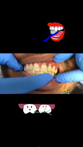 I promise I just be wanting yall yo be great!! #fypシ #dentist #funny #gross #fyp 