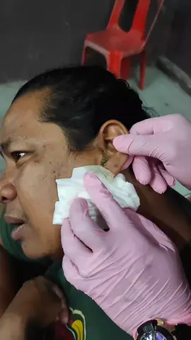 antikerak #racunintiktok #kulattelinga #keraktelinga #pembersihtelinga #nanahdalamtelinga #tungkikmeleleh 