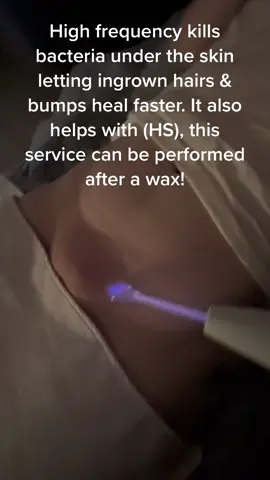 High frequency kills bacteria under the skin letting ingrown hair bumps heal faster. High frequency also helps with Hidradenitis Suppurativa, this service can be performed after a wax!!  #tulsaesthetician #tulsaoklahoma #tulsa #tulsalashes #tulsasalon #tulsawaxer #tulsaspa #bixbyoklahoma #bixby #bixbysalon #bixbyesthetician #bixbywaxer 