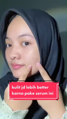 seneng bgt kalo kondisi kulit udh better kek ini😫✨ @kfskincosmeticshop #KFBeautiesSquad #GlowingWithKFskin #KFSkinCosmetics #KFBeauty #SerumdermavitC #Serumkfskin #SerumVitC 