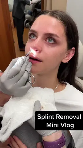 Been counting down the days for this removal, it felt SO GOOD :’) #septoplasty#splintremoval#deviatedseptum 