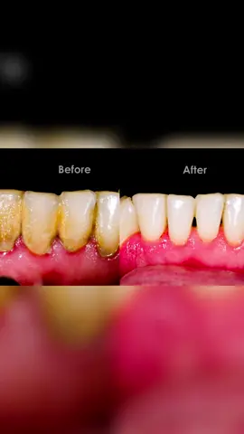 https://indulge-allure.myshopify.com/products/electric-ultrasonic-dental-calculus-remover-teeth-cleaner-dental-cleaning-teeth-whitening-scaler-dental-tartar-remover-oral-care