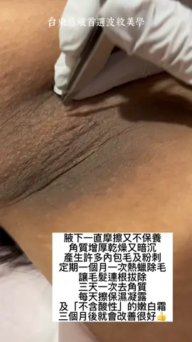這麽黑的腋下你看過嗎？！#腋下保養#腋下除毛 #熱蠟腋下#台東熱蠟#嫩白霜 #去角質推薦 #葡萄籽去角質粉#私密處嫩白霜 @淳淳｜私密花園園藝大師｜ @下面惠漂亮的私密保養師 @用技術在玩毛的專家-霧峰首選就是我 