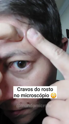 Cravos do rosto no microscópio 😳 #cravos #microscopio #mundomicro 