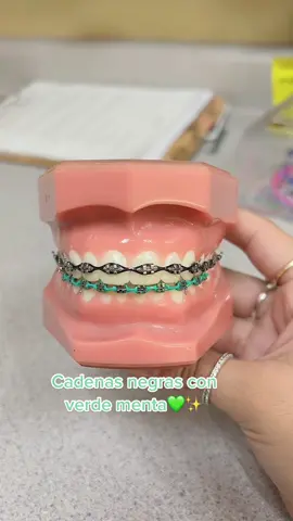 #orthodontist #ortodoncia #brackets #dientes #sonrisa #cadenas #colores #verde 