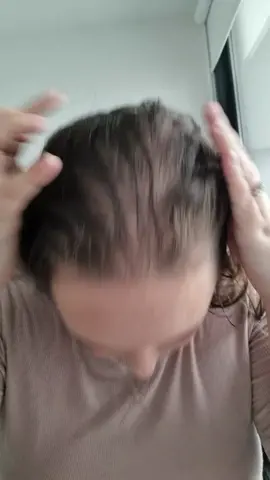 #fyp #highlinewigs #alopecia #beforeandafter #tranformation #hairloss #hairtok 