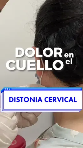 Distonía Cervical 💉 👩‍⚕️ Si tienes dudas o inquietudes no dudes en consultarnos, nuestra línea de WhatsApp es el 3165803224. Visita nuestro perfil donde encontrarás mayor información de cómo cuidar tu salud y tener una mejor calidad de vida. #Cifel #Fisiatria #Fisiatría  #Rehabilitación #Electrodiagnóstico #Toxinabotulinica #toxina #migraña  #dolorcuello #Dolor #electromiografía #Rehabilitacion #Artrosis #Fibromialgia #TunelDelCarpo #Radiculopatia #Radiculopatía #Tendinitis #rodilla #pie#sindromedeltuneldelcarpo #tunelcarpiano #Bursitis #DolorLumbar #Terapias #Epicondilitis #ejercicio #Fitness #trabajar #correr 