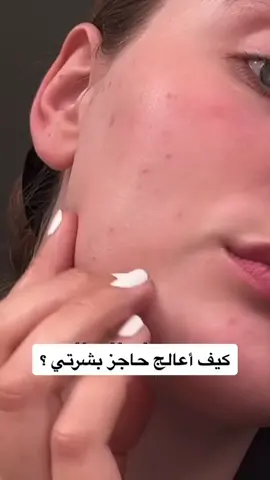 الحلزون المتقدم 92 ، كريم الكل في واحد ، 3.52 أوقية (100 جم 92٪ من ترشيح إفراز الحلزون (Mucin) ، هذا الكريم يساعد بشكل طبيعي على خلق توهج جذاب للبشرة الصحية. كريم الحلزون المتقدم الكل في واحد الذي يدعم التجدد الطبيعي للبشرة التالفة لتقليل ظهور التجاعيد. 