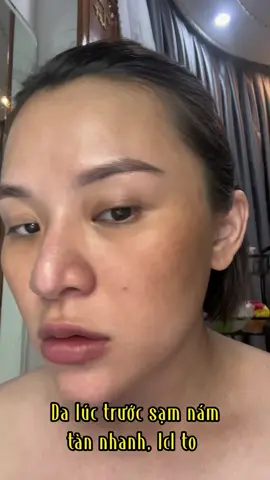 Da bà nào sạ.m n.ám, dưỡng kem hoài ko cải thiênn thì tham khảo thử nha #nguyenngocthaohts #bầuvẫnphảixinh #TikTokPromote 