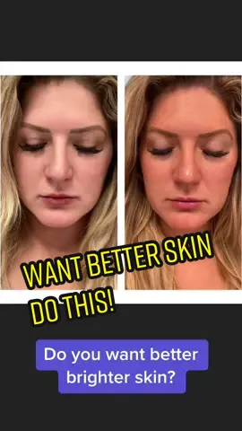#modere #collagen #moderetrim #beforeandafter #beforeafter #collagendrink #socialretail #nurse #supplements #energydrink #chocolate #protein #energy #realresults #wow 