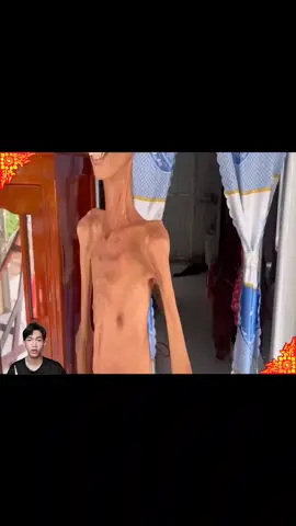 Người đàn ông gầy nhất đông nam á