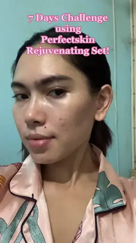 This is only a 1 week feedback/result! I am not expecting to have clear and glass skin atleast its improving and its giving me the glow I want, thank you @Perfectskin Main balikan natin to after 1month 🥰 #perfectskin #perfectskinrejuvenatingset #tatakperfectskin #alagangperfectskin #perfectskinlangmalakas❤️ #perfectskinuser #7dayschallenge #perfectskinmain #perfectskincare 