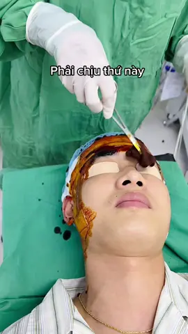 Nâng mũi nam thần 