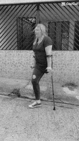 #amputegirls #oneleg #🙋🏼‍♀️ 