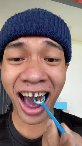 hAyo siapa nih yang gigi nya bolong depan juga😭😁 #transition #gigi #lubang #gigidepan #lobang #beforeandafter #gigiberlubang #trend #foryou #fyp #foryoupage #viralditiktok #viral #tiktokindonesia #tiktok #beranda #xyzbca #YAYAT #muhfadlyhidayat 