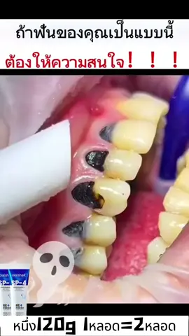 จัดส่งฟรี COD(มี)ราคาต่ำสุดวันนี้ 116.7฿วันนี้เท่านั้น!!! ไม่เพียงแต่ทำให้ลมหายใจสดชื่น แต่ยังทำให้ฟันขาวขึ้นอีกด้วย ไปตรวจเลย!