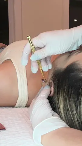 ASMR ear acupressure face mapping and face exam @Ivy B ASMR #asmrrealperson #asmrfacemapping #asmrfaceexam #asmrsensory #asmrdoctor #asmr_tingles #asmrmedicalroleplay #asmrvideo #asmrmedicalroleplay #asmr #asmrroleplay 