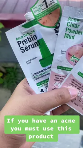 You must try this Oxecure Product #oxecureph #oxecureacnedefenseprebioserum #oxecureacneclearpowdermud #tiktok #fyp 