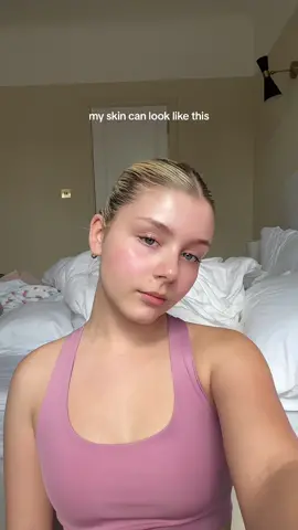 dont compare yourself to anyone. we all have real skin and real perfect imperfections 🧘🏻‍♀️ #realskin #MentalHealth 