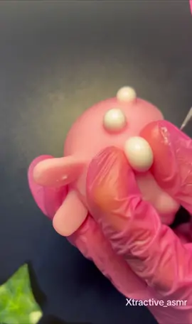 So satisfying! #asmr #visualasmr #pimplepop #fyp 