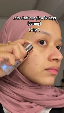 My 14 days journey with @skintific.my symwhite 377 serum!✨🤍 #glowingskin #skintificserum377 #symwhite #skintific #serumviral #serumdarkspot #fyp 