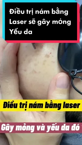 Điều trị sắc tố bằng laser có gây mỏng yếu da .#laser #lasertannhang #lasernamchansau #namchansau #HoaHeraskincare 