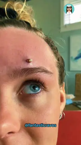 O final é o melhor😲👁️❗ #espinhagigante #espinhanatestadaloira #satisfatório #fantasticravos 