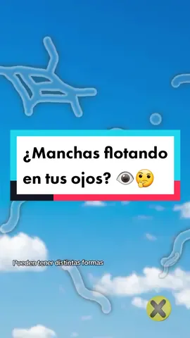 ¿Has visto manchitas flotando en el aire? 👁🤔 ¡Te explicamos que son! #curiosidades #AprendeEnTikTok #datoscuriosos #xpresstv 