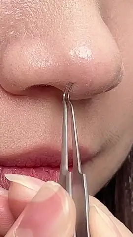 yuk klik keranjang kuning #pinsetkomedo #pinsetjerawat #komedohilang #fyp 