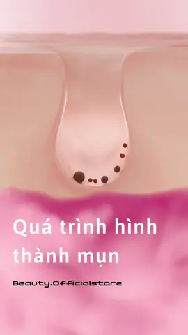 Quá trình hình thành mụn.#TryItWithTikTok #thammy #làmđẹp #viralvideo #LearnOnTikTok #reviewlamdep #fyp #fypシ #lamdep #mụn #trimun 