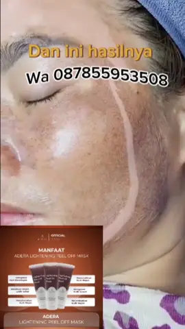Hubungi 087855953508 untuk konsultasi dan pemesanan #fyp #trending #viral #serum #jerawat #acne #serumviral #GlowUp #serumviral #adera #tki #tkitaiwan #tkihongkong #tkimalaysia 