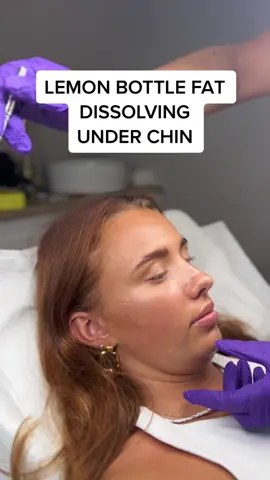 Took a little holiday but im back ✨ Lemon Bottle Under Chin FAT DISSOLVING #lemonbottleinjections #lemonbottle #fatdissolving #lemonbottleuk #lemonbottlebeforeandafter #fyp #lemonbottlefatdissolving 
