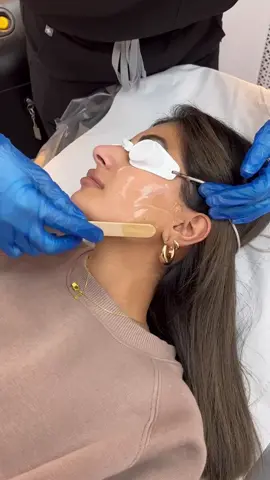 WHY CHOOSE SOPRANO ICE TITANIUM FOR LASER HAIR REMOVAL?  * We can treat all skin types Fitzpatrick 1-6 * No more ingrown hairs, scarring and smoother skin 24/7 * We can treat most hair colours except blond, grey and red hair * We can even treat tanned skin so no need to stop treatments after your summer holiday like you do with IPL hair removal & traditional laser hair removal * It’s a very effective treatment, it uses 3 wavelengths simultaneously during treatment unlike the older Soprano model (Soprano Ice) that only use 1 wavelength which is less effective at clearing the hair. * Yag Wavelength allows us to treat darker skin tones safely and effectively. * It’s safe! With proven safety records #laserhairremoval #laserhair #laser #birminghamlaserhairremoval #laserhairremovaltreatment #skinclinic #fijiskinclinic 