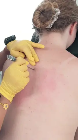 ASMR acupressure paraspinal massage | chiropractic adjustment for Hope #asmracupressure #acupressuretherapy  #asmrdoctorroleplay #asmrchiropractic #asmrmedicalexam #madpasmr #asmrsensory #asmrdoctor #realpersonasmr #asmrroleplay #asmr_tingles #asmrbackmassage #asmrbackexam #asmrrealperson 