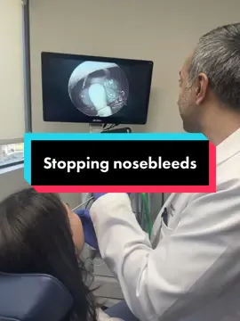 Cauterizing nasal septum for recurrent #epistaxis. #reddysinus #epistaxis #ent 